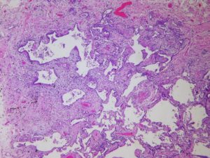 Conoce el intersticio el organo mas grande que nunca sabiamos que teniamos